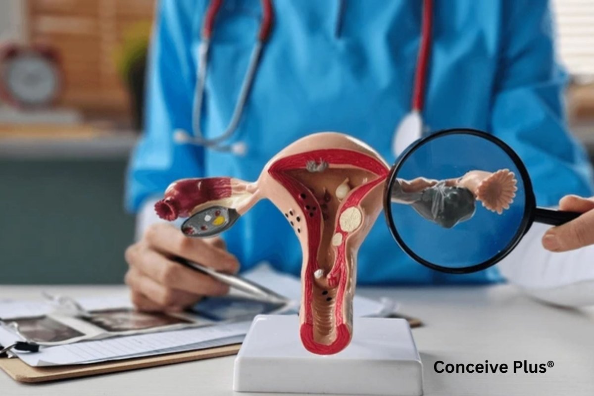 The Myo Inositol PCOS Link: A Natural Tool for Hormonal Regulation - Conceive Plus®
