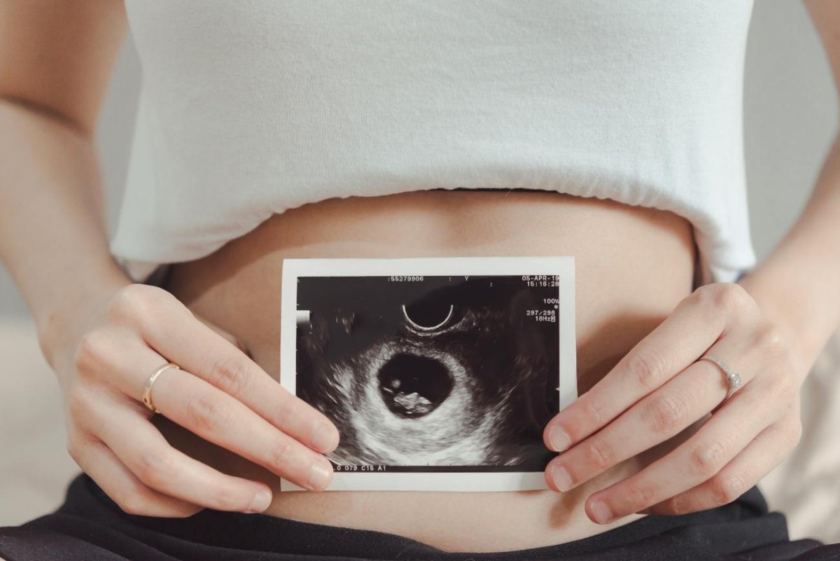 How Big Is My Womb at 12 Weeks? - Conceive Plus®