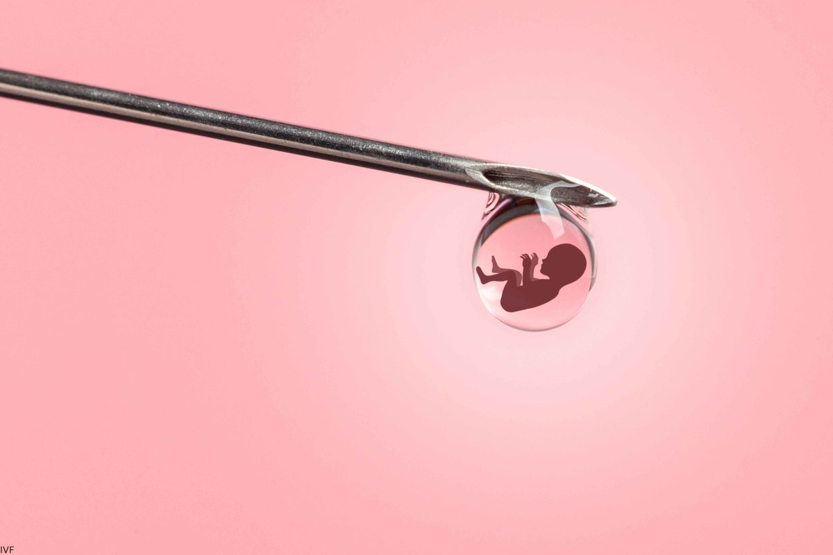 In Vitro Pregnancy Cost: Everything You Need to Know - Conceive Plus®